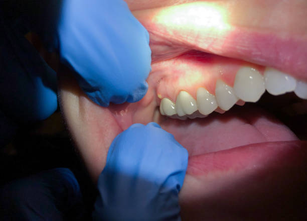 Best Emergency Tooth Extraction  in Crestwood Village, NJ